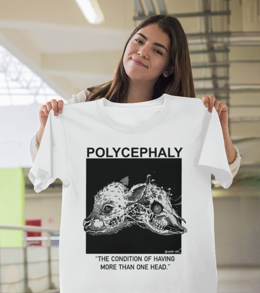 Polycephaly The Condition Of Having More Than One Head T-Shirt