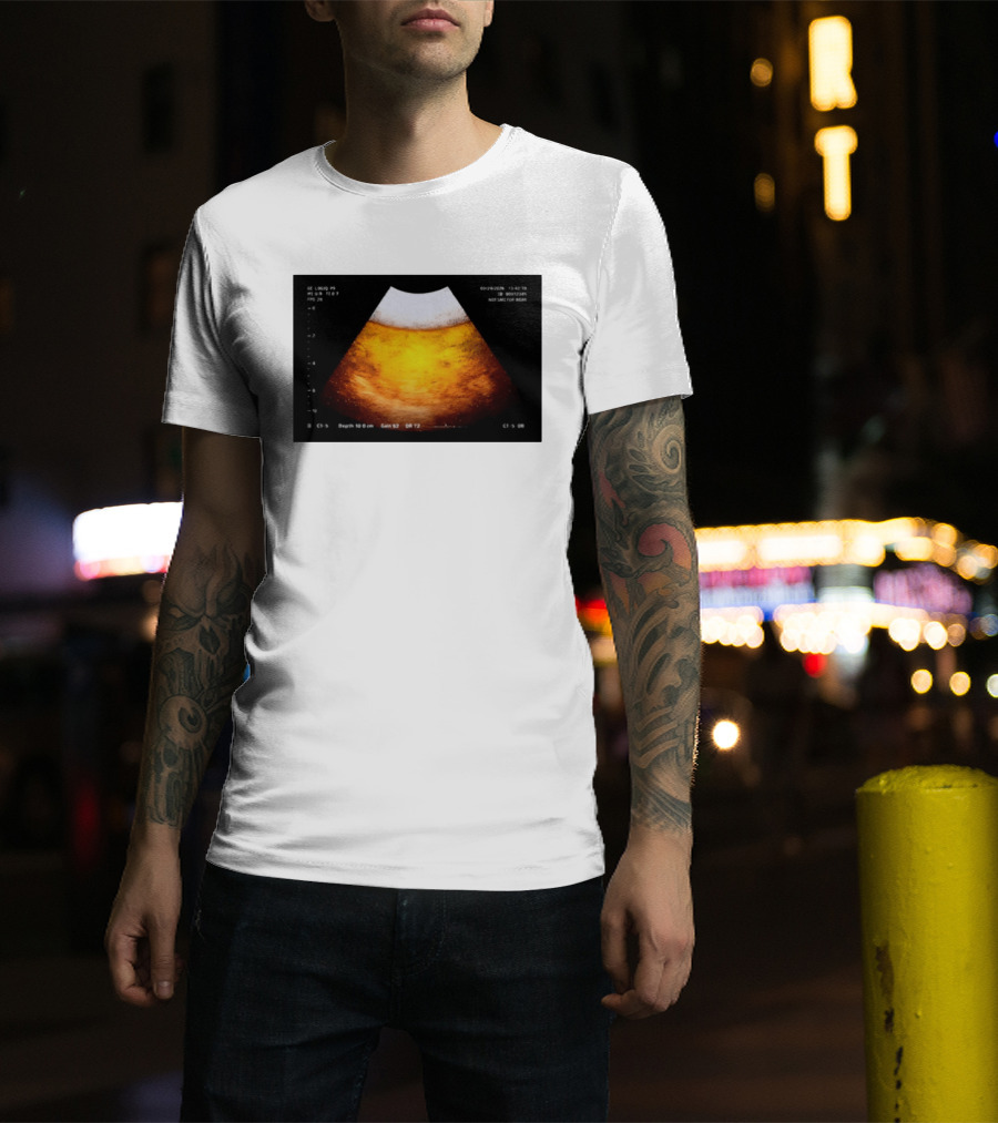 Beer Ultrasound Image Not Safe For Liver T-Shirt
