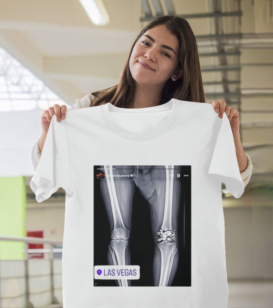 Conor McGregor X Ray Broken Knee Las Vegas T-Shirt